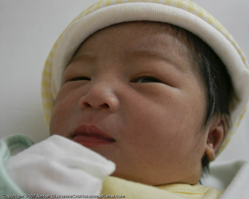 After 3 push, Baby Josh came out naturally without the swollen look 