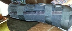 Splint 1