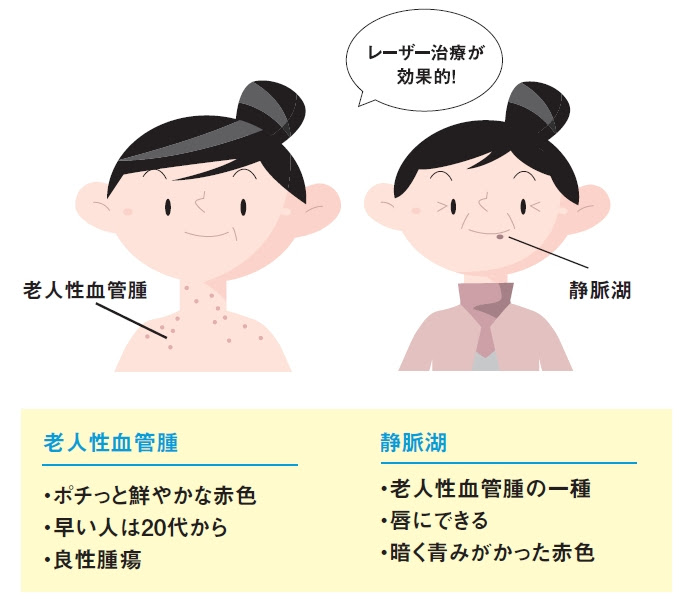 Q シミとは別に体に赤いホクロのようなものが 立川 今井皮フ形成外科クリニック