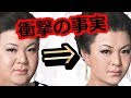 √70以上 整形 イケメン ビフォーアフター 255370