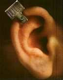 Biochip