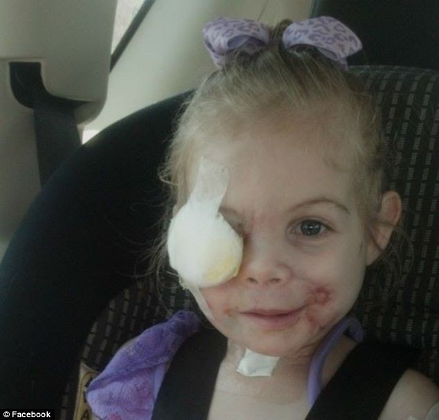 Hoax victim? An unnamed source involved in the investigation has said that all the evidence in the case points towards the matter being a hoax and that Victoria Wilcher, three, wasn't asked to leave a KFC in Mississippi because her injuries were 'scaring other customers'