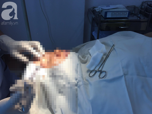TP.HCM: Một phụ nữ nhập viện cấp cứu sau khi hút mỡ bụng tại cơ sở thẩm mỹ tư nhân - Ảnh 1.