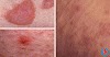 What Are Normal Blood Sugar Levels For A Diabetic : Arditor - Diabetic Neuropathy