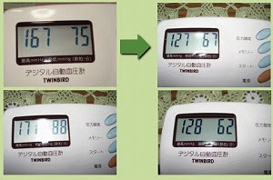 福辻式血圧を下げる方法即効性 ツボは 高血圧を下げる 福辻式 ネタバレ本