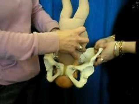 mechanism of Labour.AVI