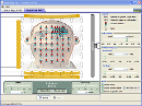 Screenshot of the simulation MRI Simplificado