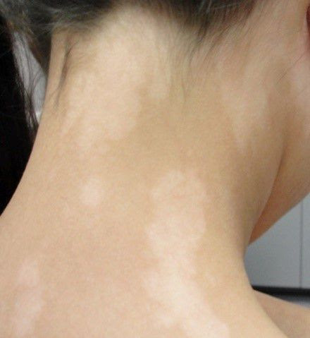 白髪が生える場所によって原因は違うのか その謎を明らかにします 美髪ラボ 白髪染め カラートリートメント総合サイト リカラ