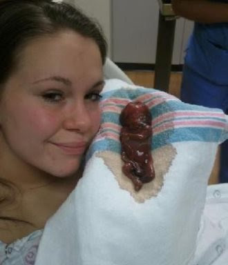 Rave News - RAVER CARRIES MISCARRIED FETUS AROUND IN PURSE ...