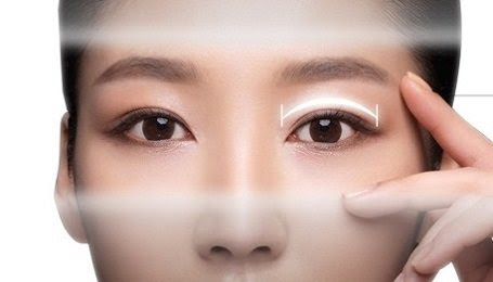 Hương Trang trước khi cắt mí mắt