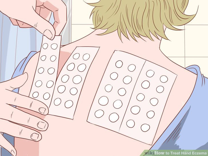 Treat Hand Eczema Step 6 Version 2.jpg