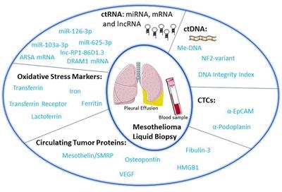 Mesothelioma With Pleural Effusion - Talc Pleurodesis Surgery For Malignant Plural Mesothelioma Treatment Rmq - A small amount of fluid normally fills the pleural cavity and .
