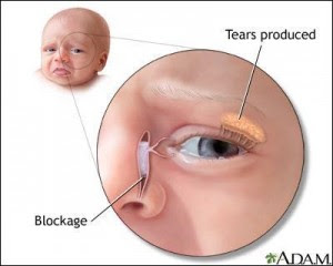 Canal Lacrymal Bouche Conjonctivite Yeux Sales Dacryostenose Osteopathie Lyon 3