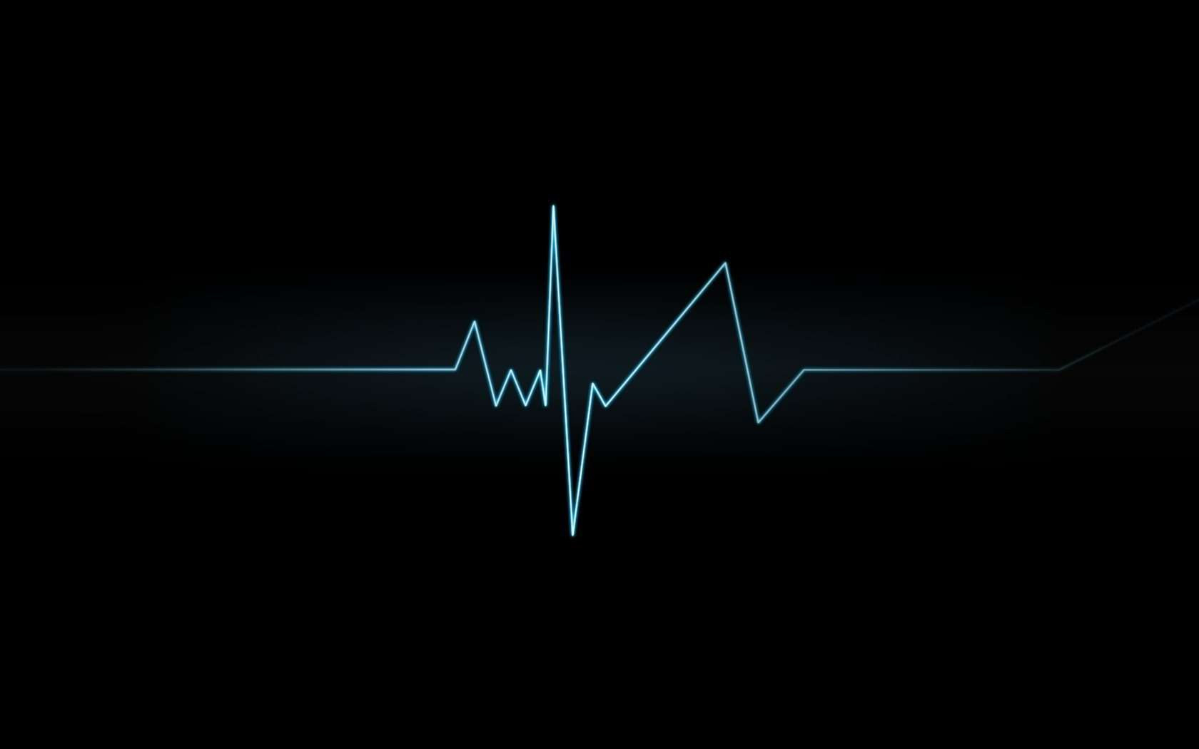 ecg line