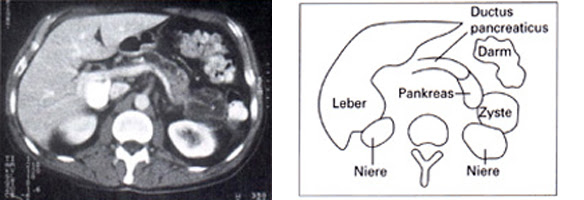 Pankreaszentrum Am St Josef Hospital Bochum