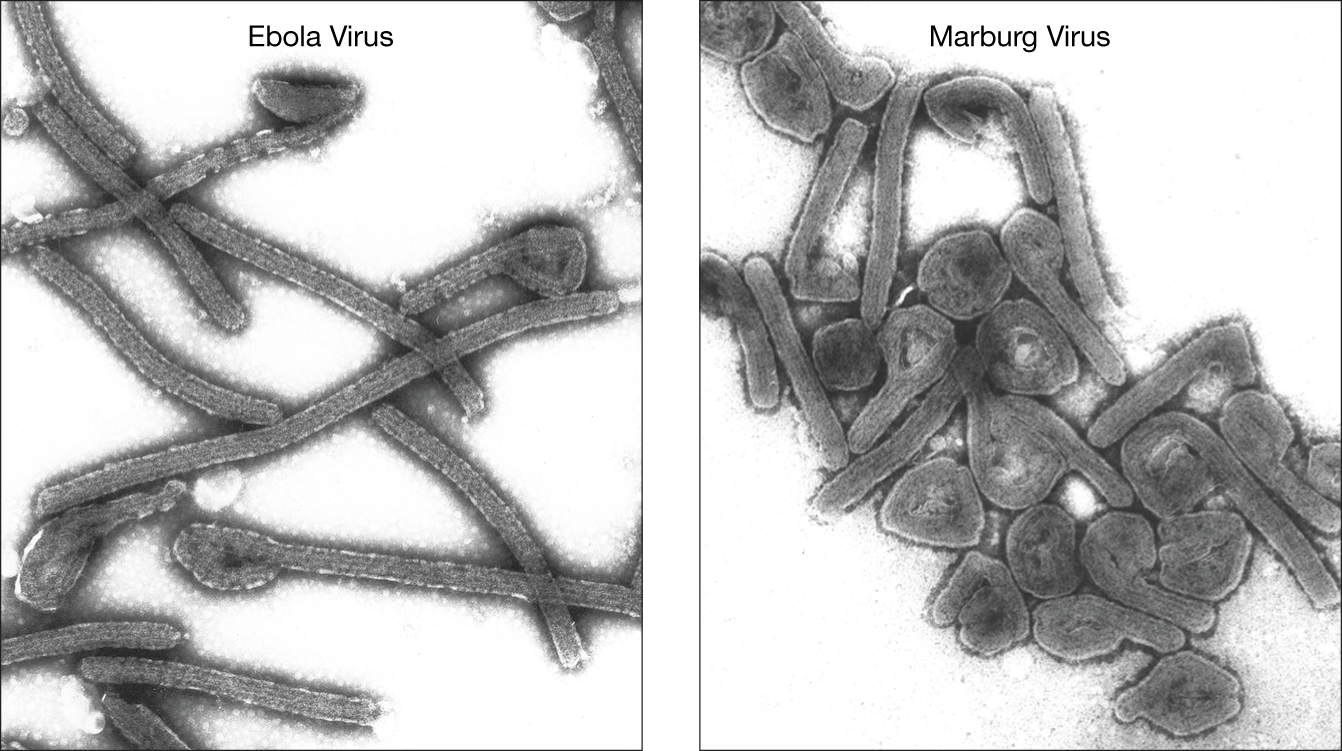 Vaccines Against Ebola and Marburg Viruses Show Promise in ...