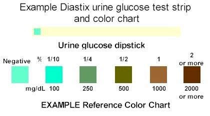  urinalysis reagent strip 2 parameters urs 2p glucose and protein test