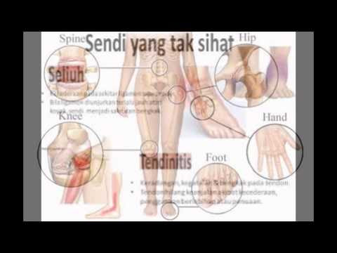 Video Obat Nyeri Sendi Di Tangan
