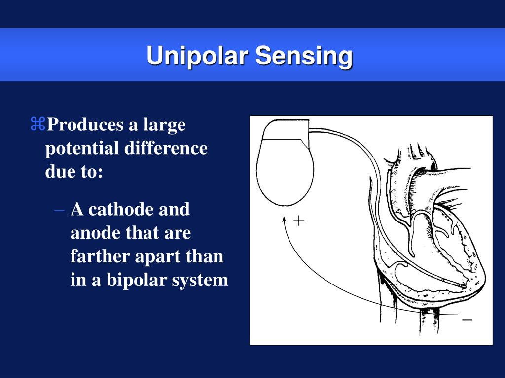 PPT - Basic Pacing Concepts Part III PowerPoint ...