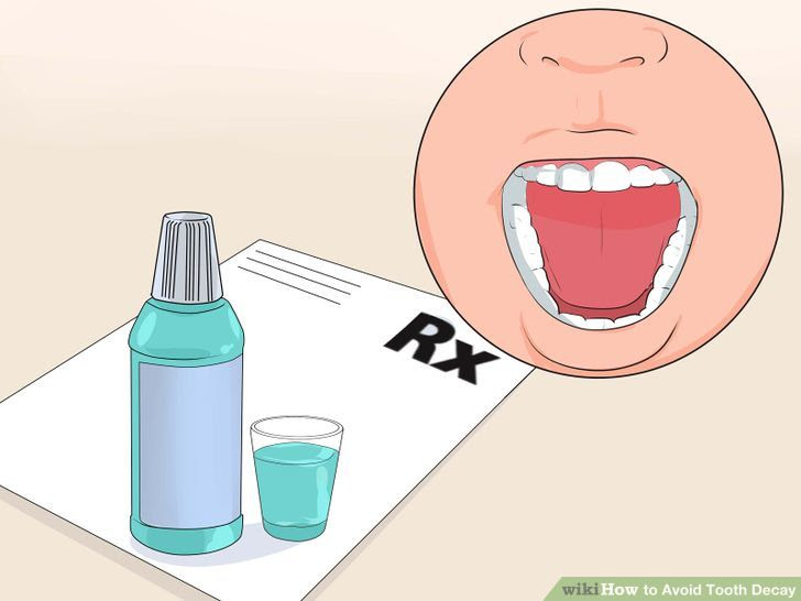 Avoid Tooth Decay Step 18.jpg