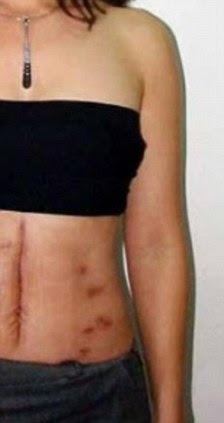 Recovery: Mrs Gorrostieta will be scarred for life after the shootings
