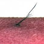 Un experimento contra la calvicie logra regenerar el pelo en ratones 