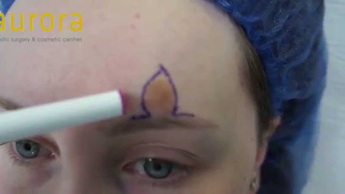 Skin Cancer Uk : How To Treat Skin Cancer - Skin Cancer Treatment Revolution - YouTube