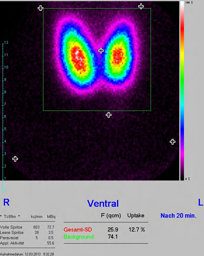 Nuklearmedizin Klinik Dr Hancken