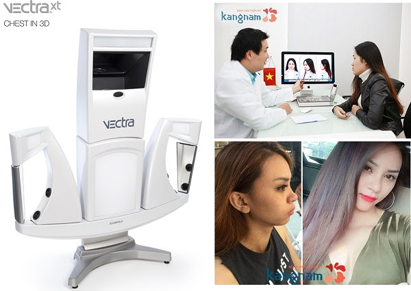 Nâng mũi có để lại hậu quả 2
