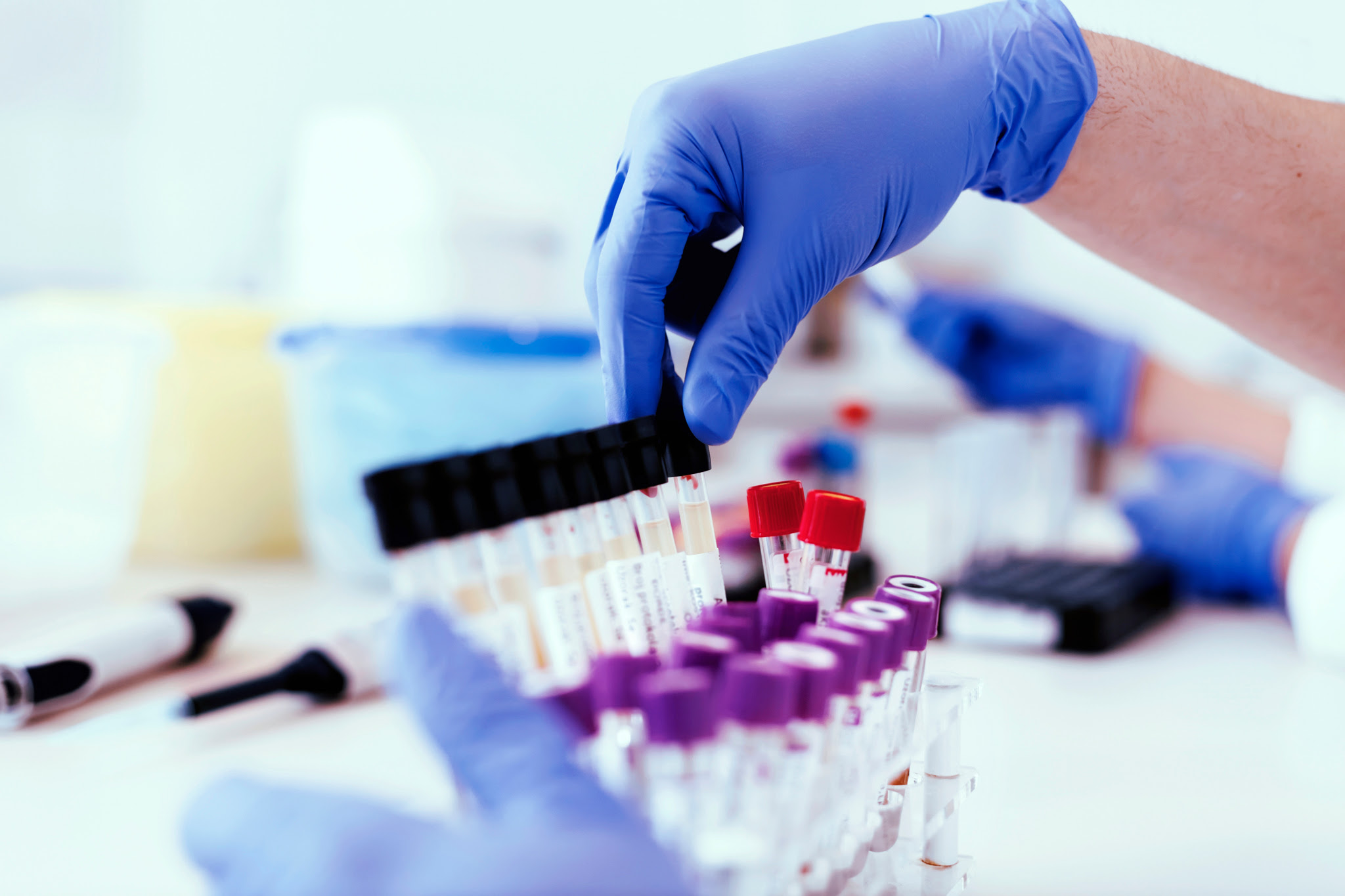 Company And Employees Battle Over Drug Testing Method