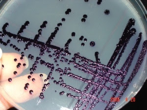 Characteristics pigment production by Chromobacterium violaceum