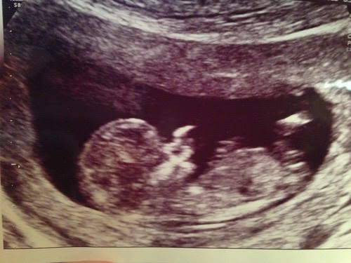 12 weeks 2 days Green Baby #4!