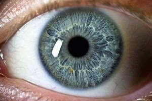 MyEye 25%