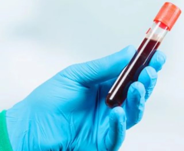   Projeto de lei propõe testes genéticos para rastreamento de doenças em adultos acima de 35 anos