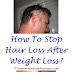 Do Vitamin D Cause Hair Loss