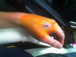 Just after the operation to insert the RFID ta...