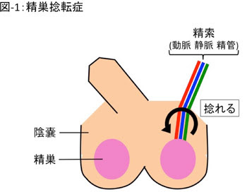 男子の精巣を守る 慶應義塾大学医学部 泌尿器科学教室