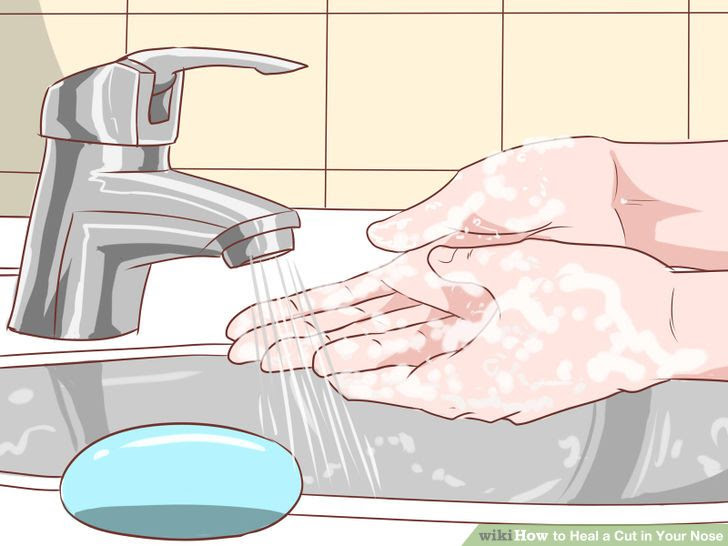 Heal a Cut in Your Nose Step 1 Version 4.jpg