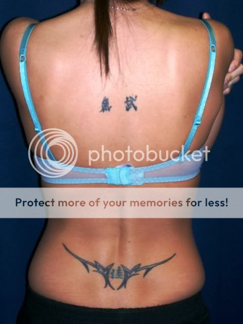 Upper Back tattoo the night after my first laser tattoo removal treatment.