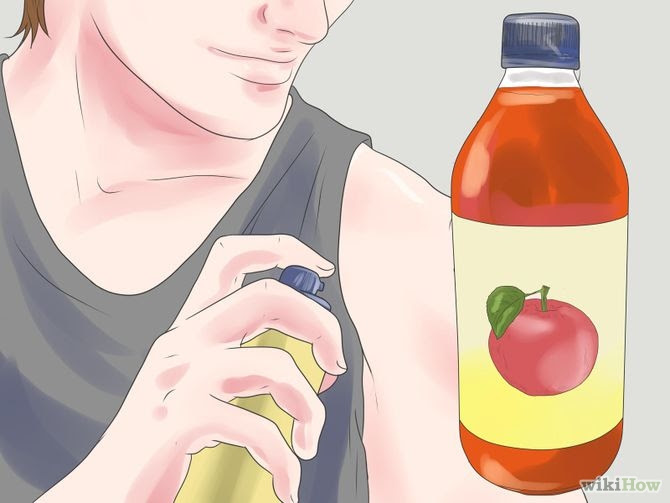 Get Rid of Bacne Step 5 Version 2.jpg