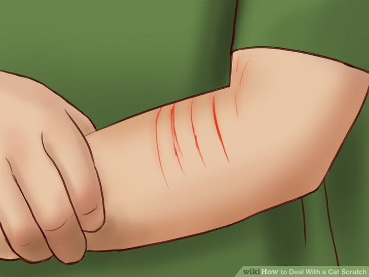 Deal With a Cat Scratch Step 3 Version 2.jpg