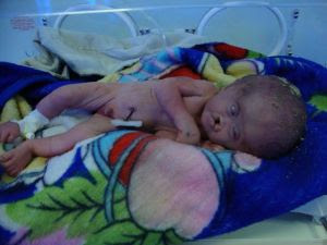 Another male born in FGH 2 days ago with multiple gross congenital anomalies in addition to CHD , he is the 1st baby to 2 young healthy couples with no previous history of any anomaly