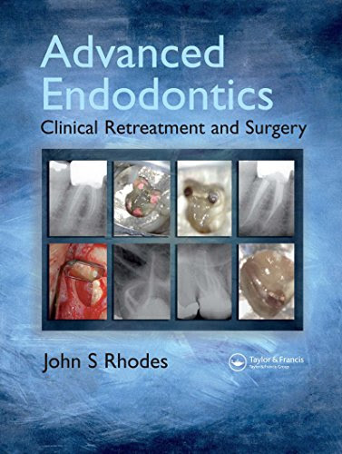 Advanced Endodontics: Clinical Retreatment and Surgery, by John S. Rhodes