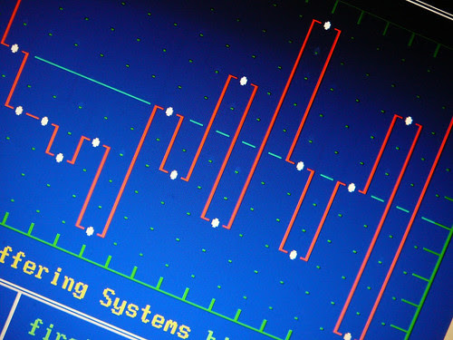 ups and downs by MelvinSchlubman
