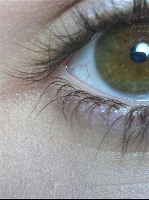  what color are my eyes be according to the martin schultz scale could