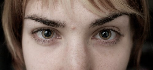 Dilated Pupils