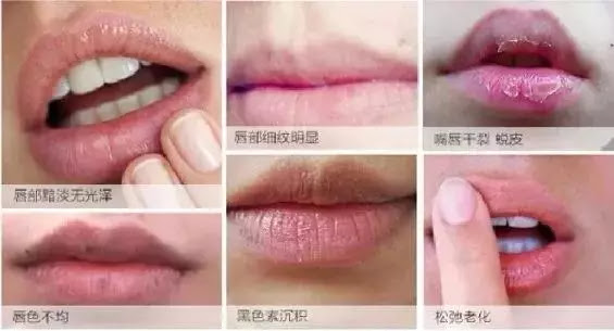 干燥脱皮 唇纹 色素沉淀 敏感的嘴唇我要如何保护它 口红