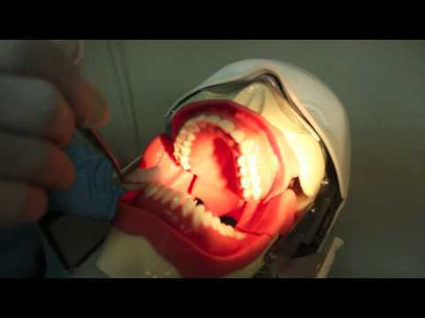 Mandibular Nerve Block : Gow-Gates Technique. Brawijaya University, Indonesia. 