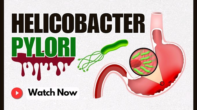 Helicobacter pylori: A Silent Intruder in Our Stomach