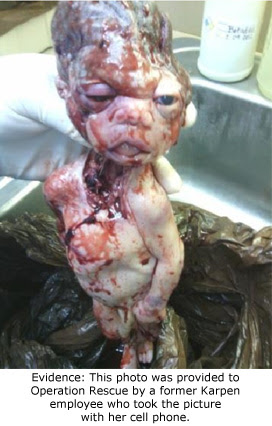Image result for late term abortion